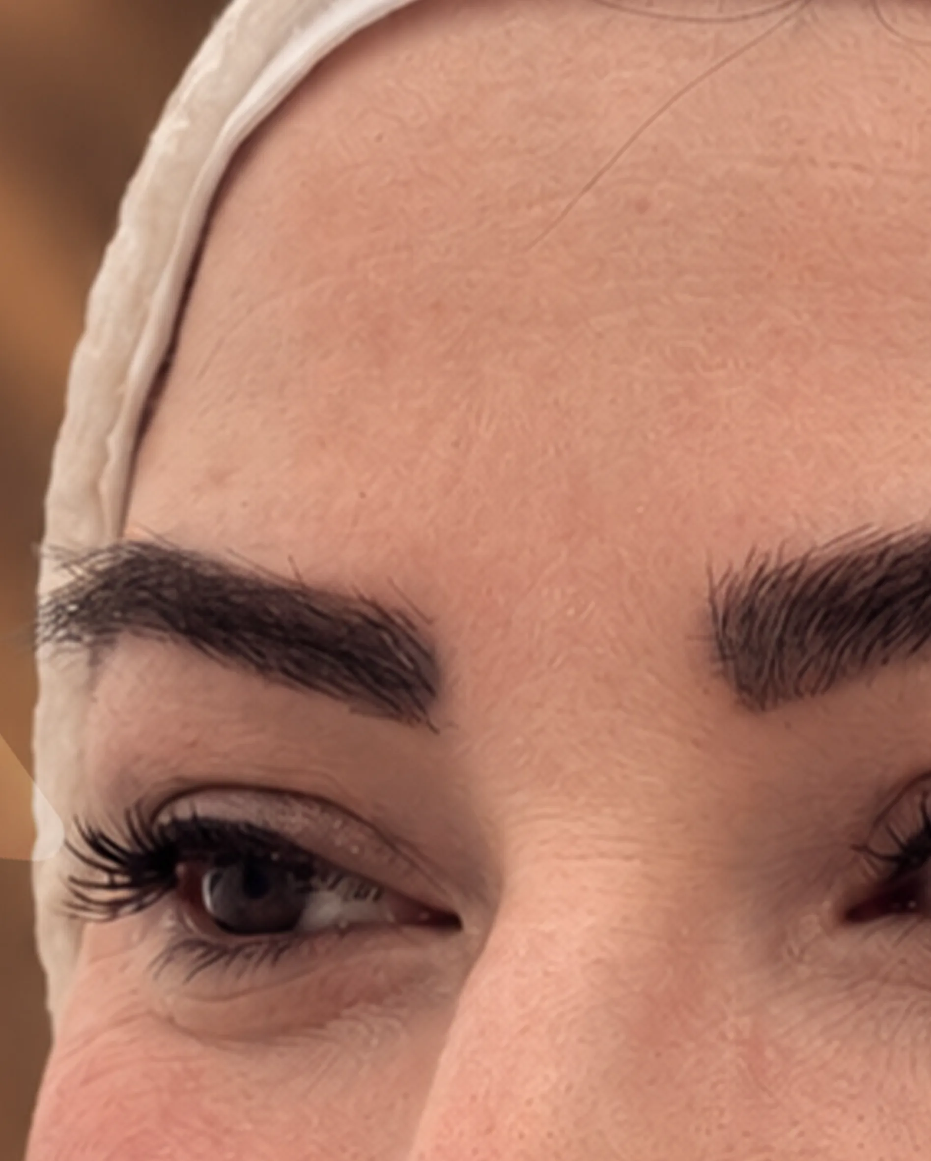 Beyaz bandajlı bir hastanın ekim sonrası kaşları ve gözleri, yakın plan.